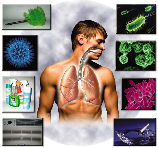 támad a legionella
